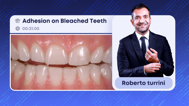Adhesion on Bleached Teeth