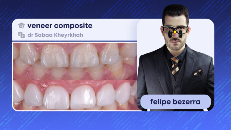 veneer composite