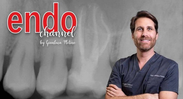 Endo-Channel_The-Excellence-in-Endodontic-Treatment-Made-Easy