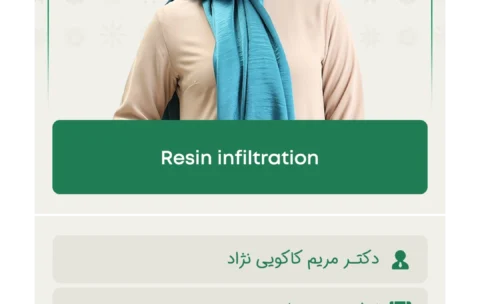 Resin infiltration (2)
