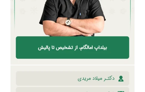 بیلداپ_امالگام،_از_تشخیص_تا_پالیش
