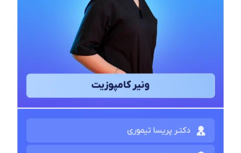 ونیر کامپوزیت دمو