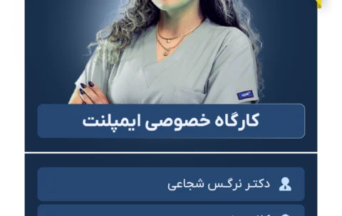 کارگاه خصوصی ایمپلنت