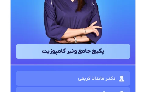 پکیج جامع ونیر کامپوزیت