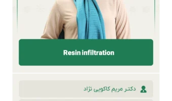 Resin infiltration