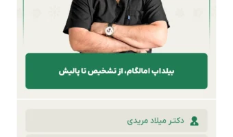 بیلداپ_امالگام،_از_تشخیص_تا_پالیش