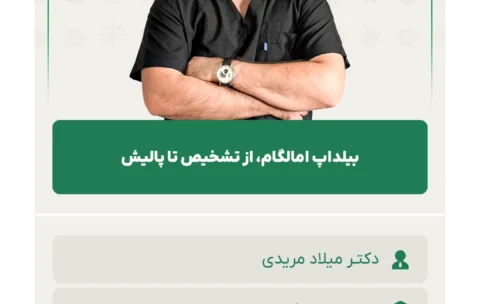 بیلداپ_امالگام،_از_تشخیص_تا_پالیش