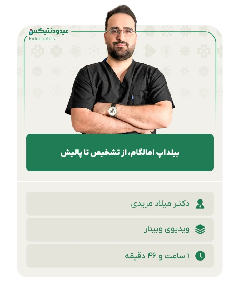 بیلداپ_امالگام،_از_تشخیص_تا_پالیش