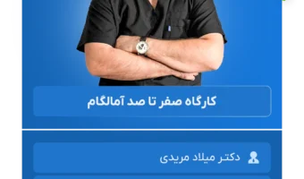 صفر تا صد آمالگام