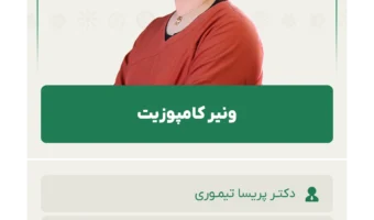 ونیر کامپوزیت