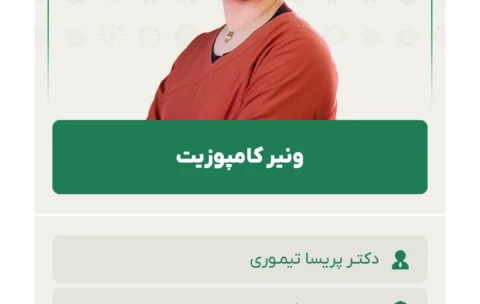 ونیر کامپوزیت