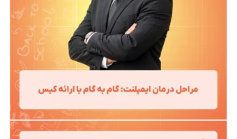مراحل درمان ایمپلنت