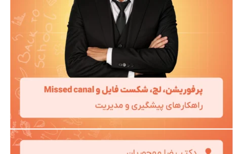 پرفوریشن، لج، شکست فایل و Missed canal
