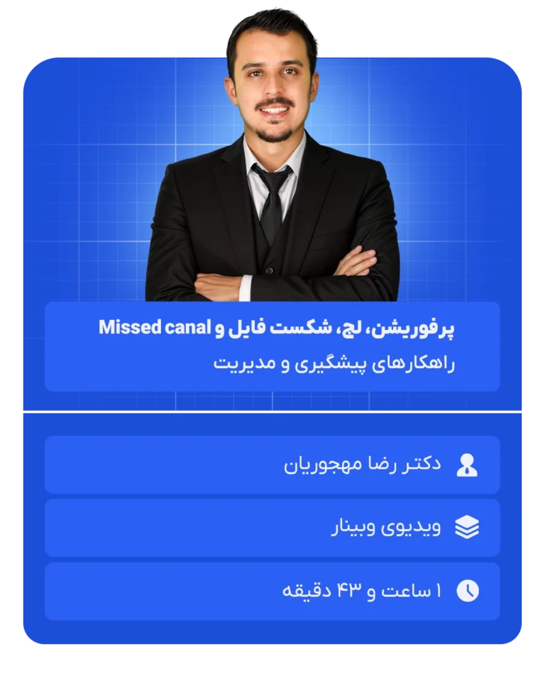 پرفوریشن، لج، شکست فایل و Missed canal