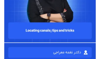 Locating canals; tips and tricks